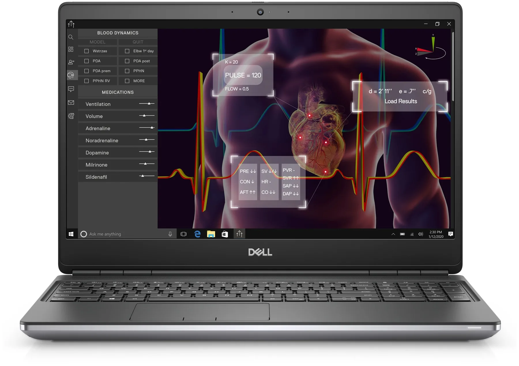 Dell Precision 7750 (i7-10850H, 16GB, 512GB, RTX 3000 6GB, 17.3 FHD IPS) - Mặt trước