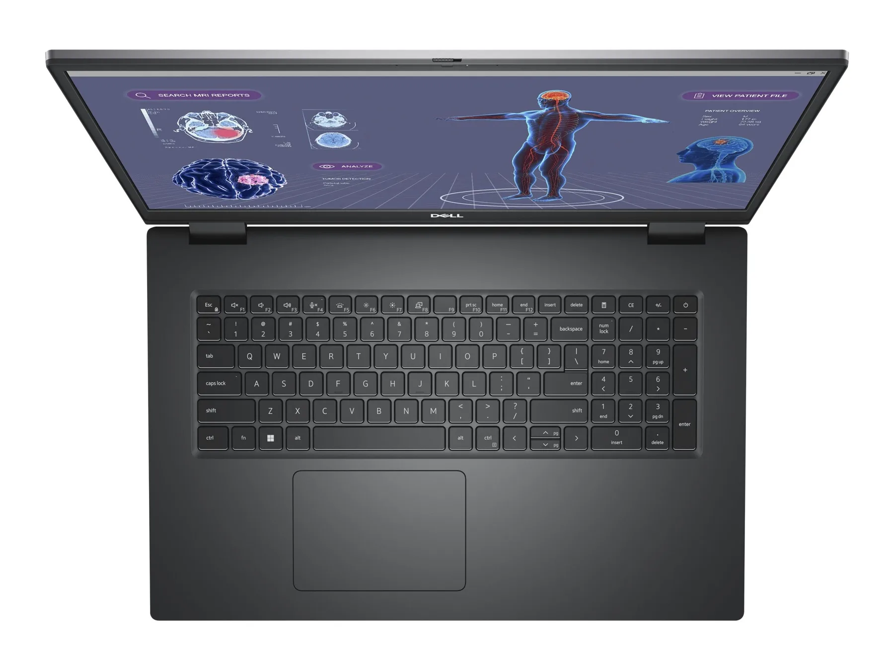 Dell Precision 7780 (2023) (i9-13950HX, 32GB, 512GB, 17.3 inch FHD 1920x1080) - Bàn phím và touchpad