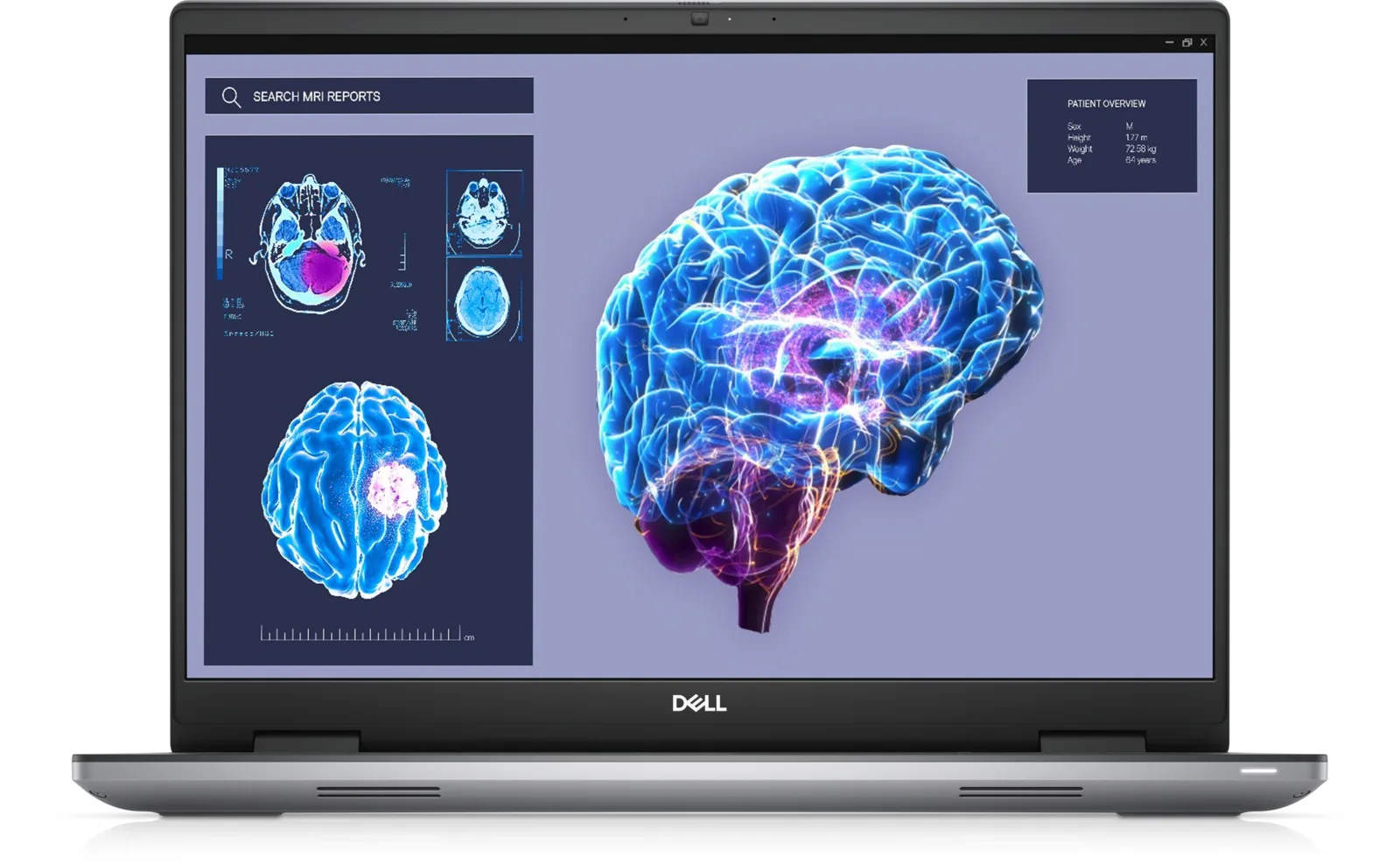 Dell Precision 7680 (2023) (i7-13850HX, 32GB, 512GB, 16.0 inch FHD+ 1920x1200) - Mặt trước